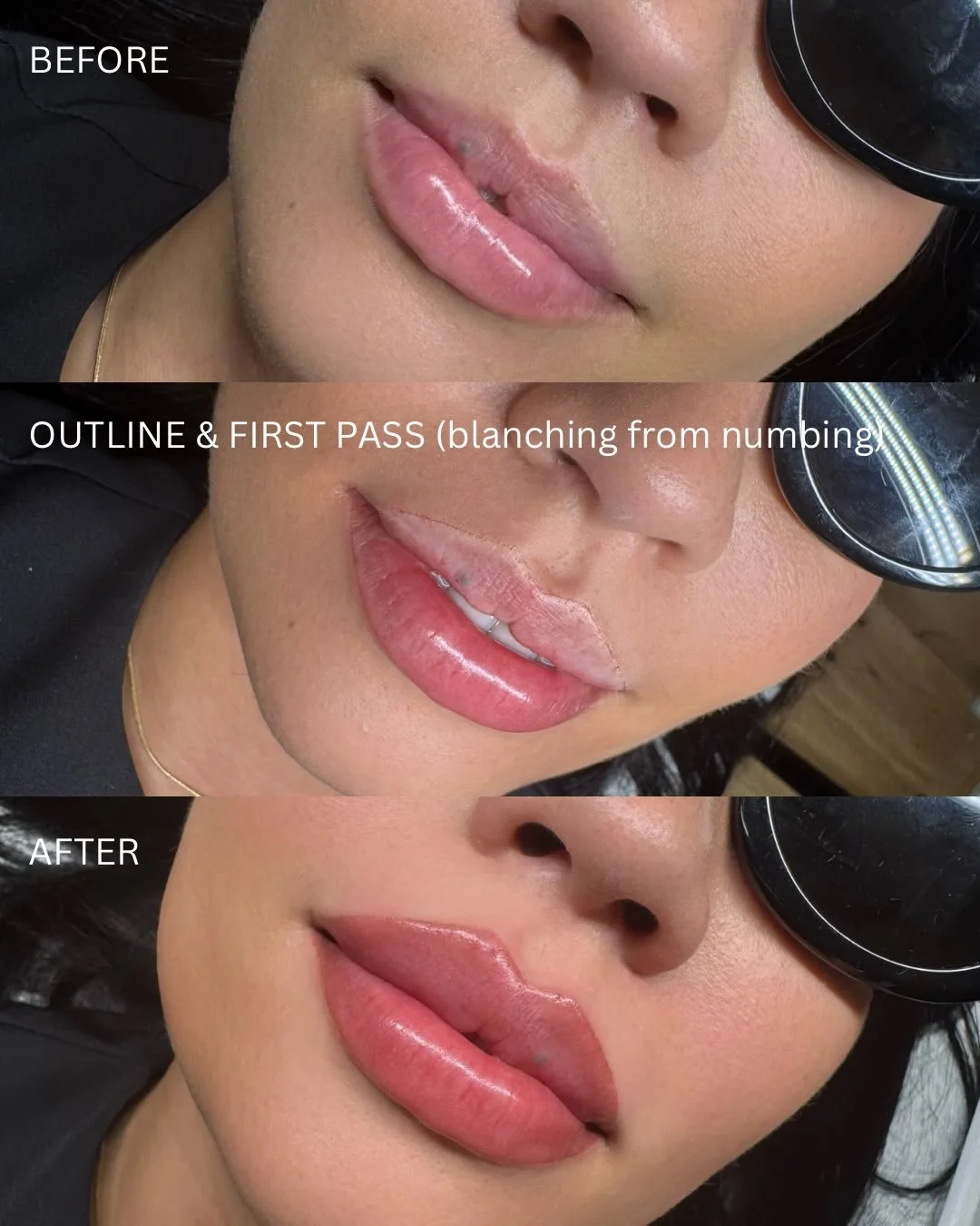 Ever wonder what the lip blush process looks like?⬇️

This is why I always tell clients to trust the process. Lip blush heals in stages &mdash; from initial swelling + bold color, to peeling/lightening, to a soft healed result once the pigment settle