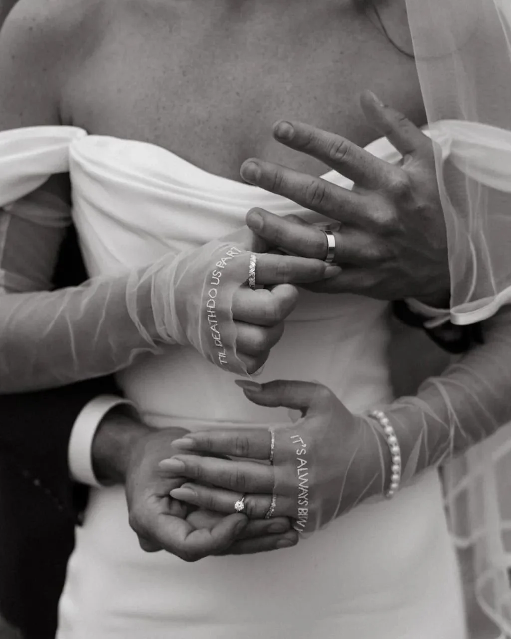 Close-up of two hands in wedding rings resting on a person's chest, with medical wristbands and delicate jewelry, in a hospital room setting.