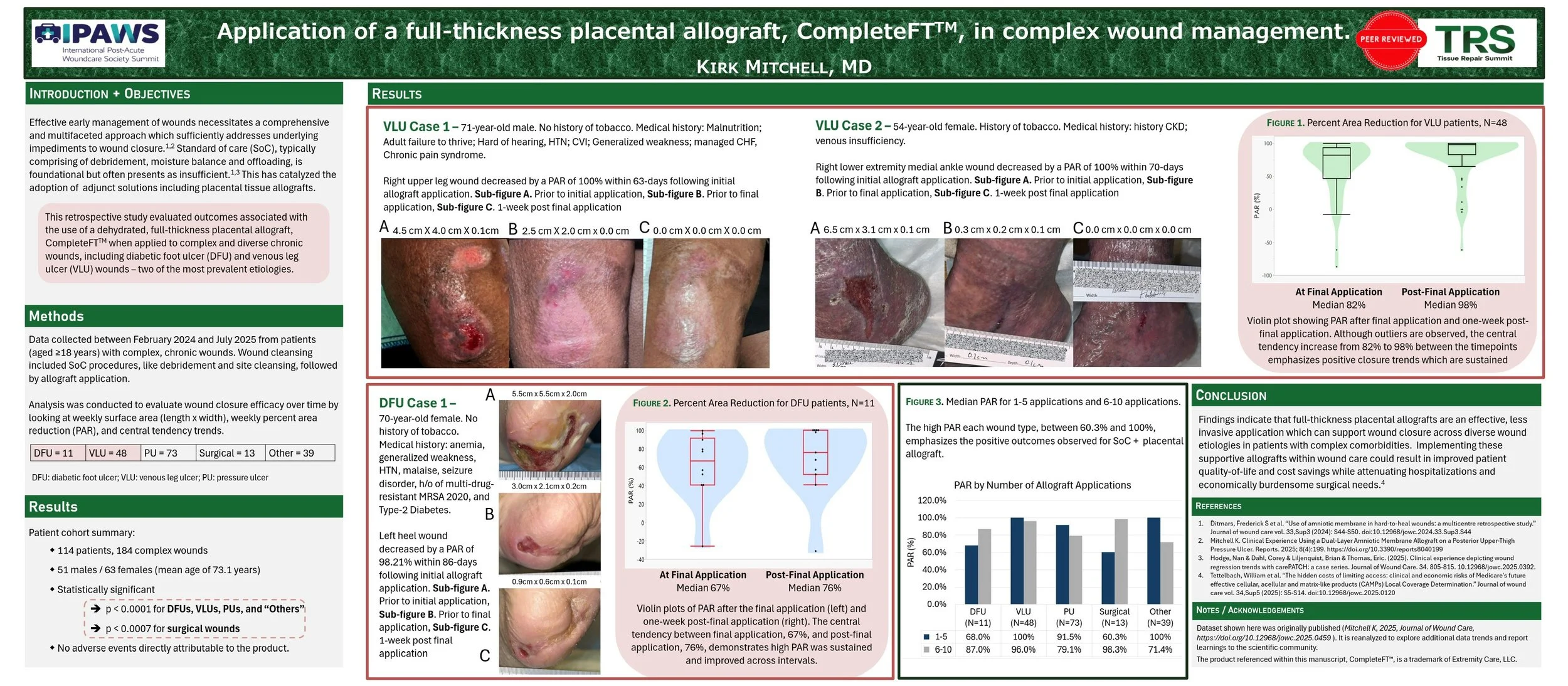 Person in a dark suit pointing at research posters on a whiteboard in a conference setting.