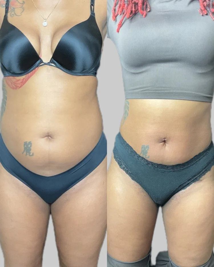 LL + 20_20_20JPG.JPG