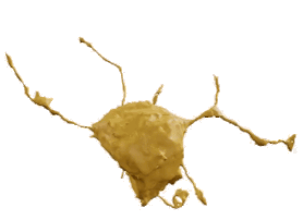 Oligo dendrocyte