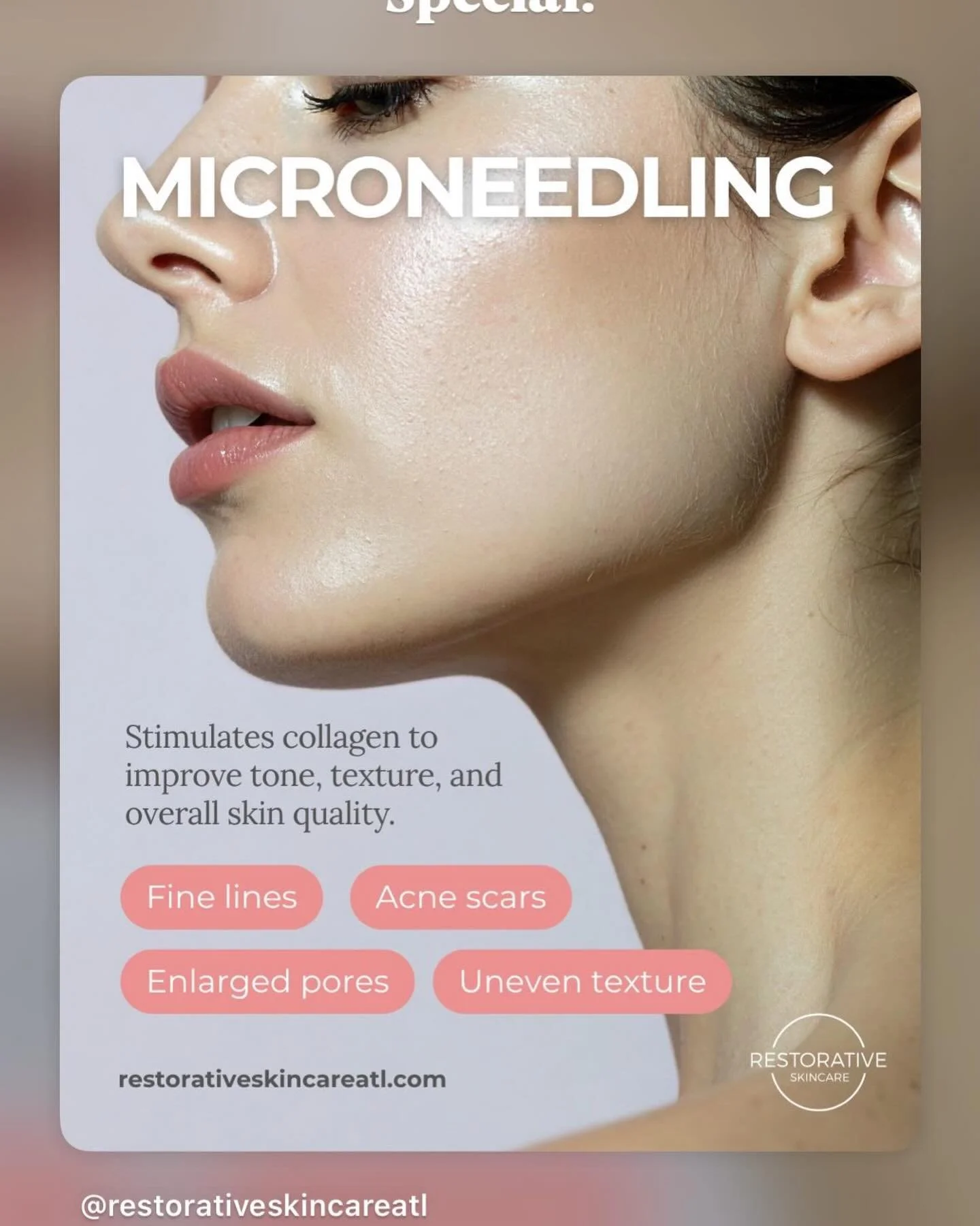 Pore-Refining Microneedling Treatment: face, neck + chest is now $375.
💧 NO downtime ✨ Nothing but glow
🧖🏼&zwj;♀️PLUS &mdash; complimentary upgrades-$210 VALUE: &bull; HydraFacial extractions &bull; Lymphatic drainage massage/aromatherapy 
🧖🏼&zw