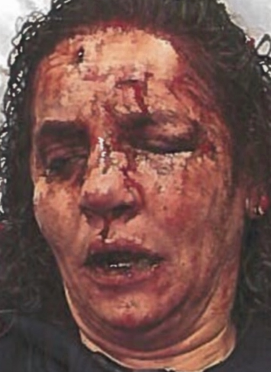 Photo taken in Ambulance