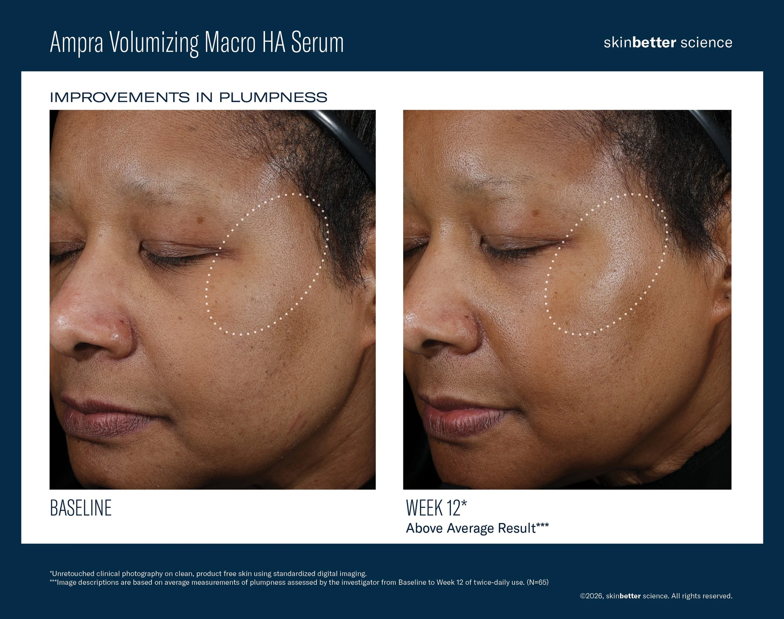 Ampra_B2B_B&ATemplate2 (1).jpg