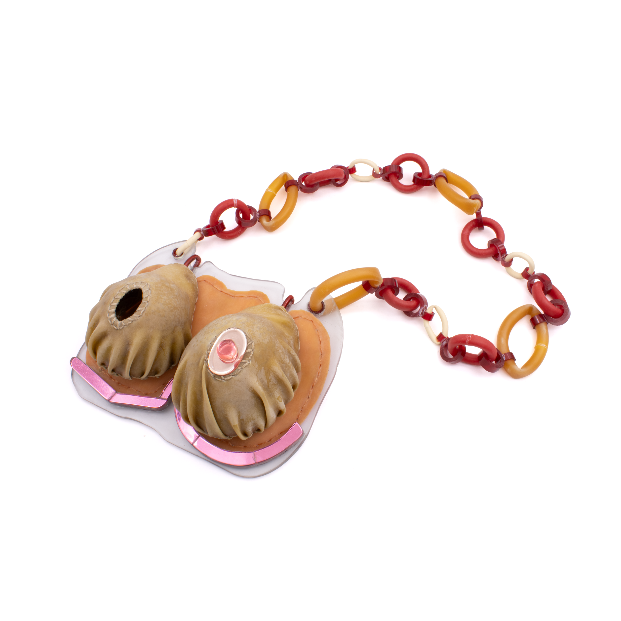 Double Incision with Nipple Retention (Buttonhole)