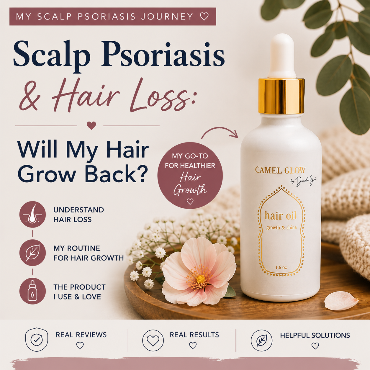 Scalp Psoriasis and Hair Loss: Will My Hair Grow Back?