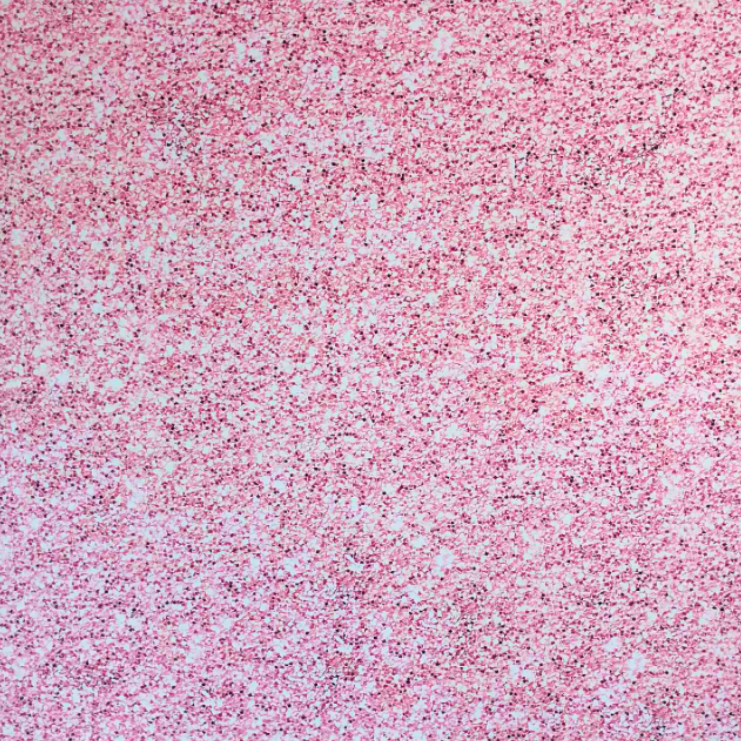 Pink Sparkle