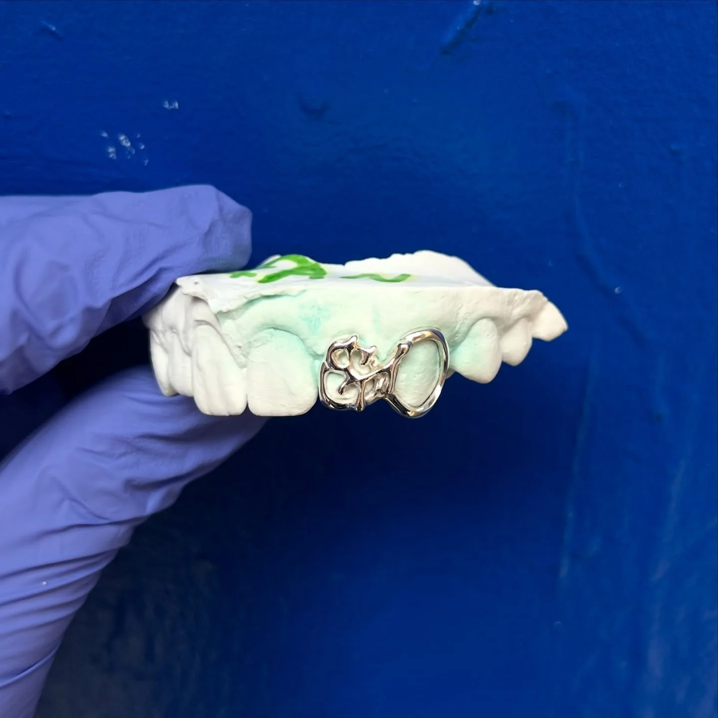 Abstract thingamabob Grillz 😳🥰
