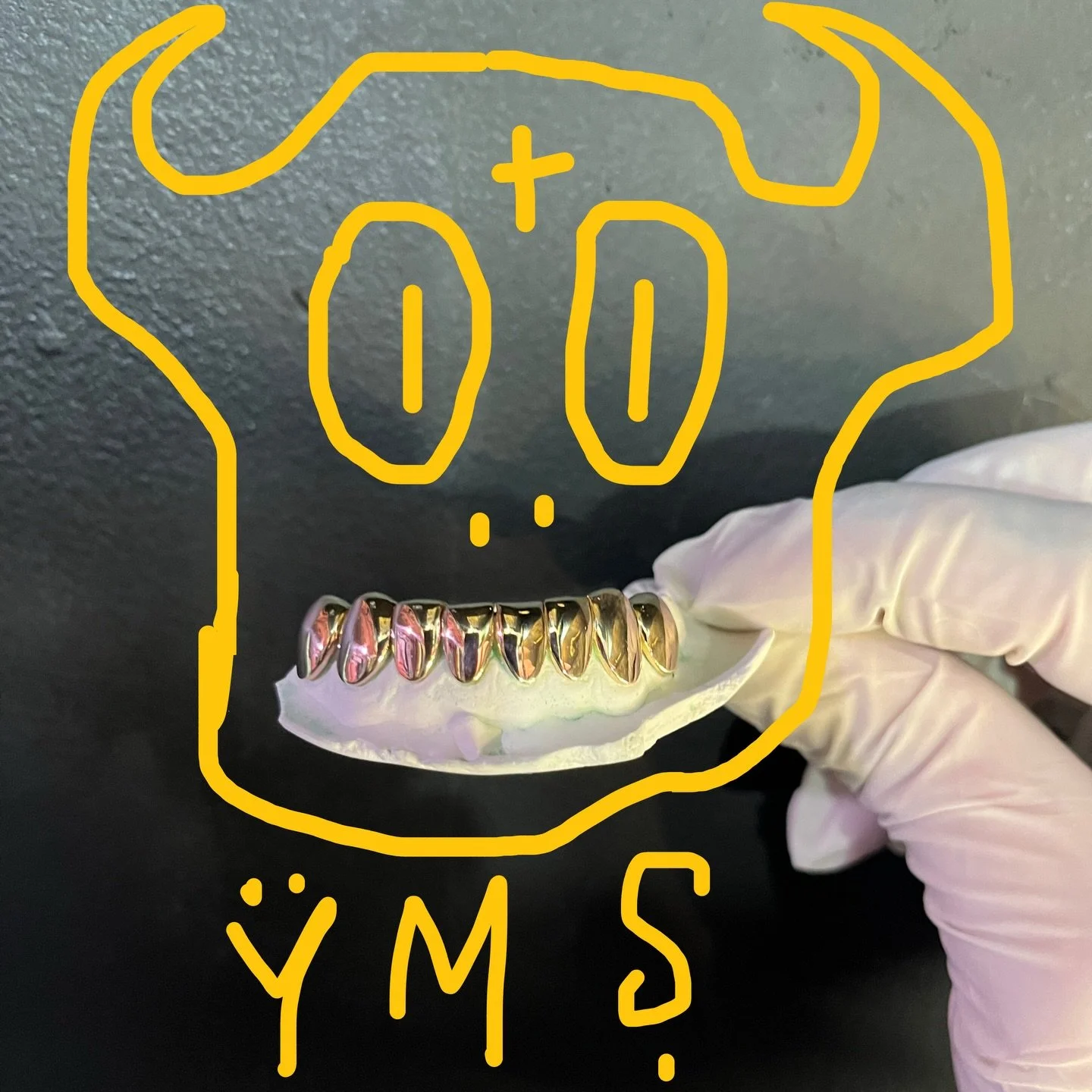 8 wall golds 🍯 Perm cuts fronts and deep cuts backs hand crafted in Calgary Canada ✨ Swipe to see the back of the grillz ➡️ #bespokejewellery #local