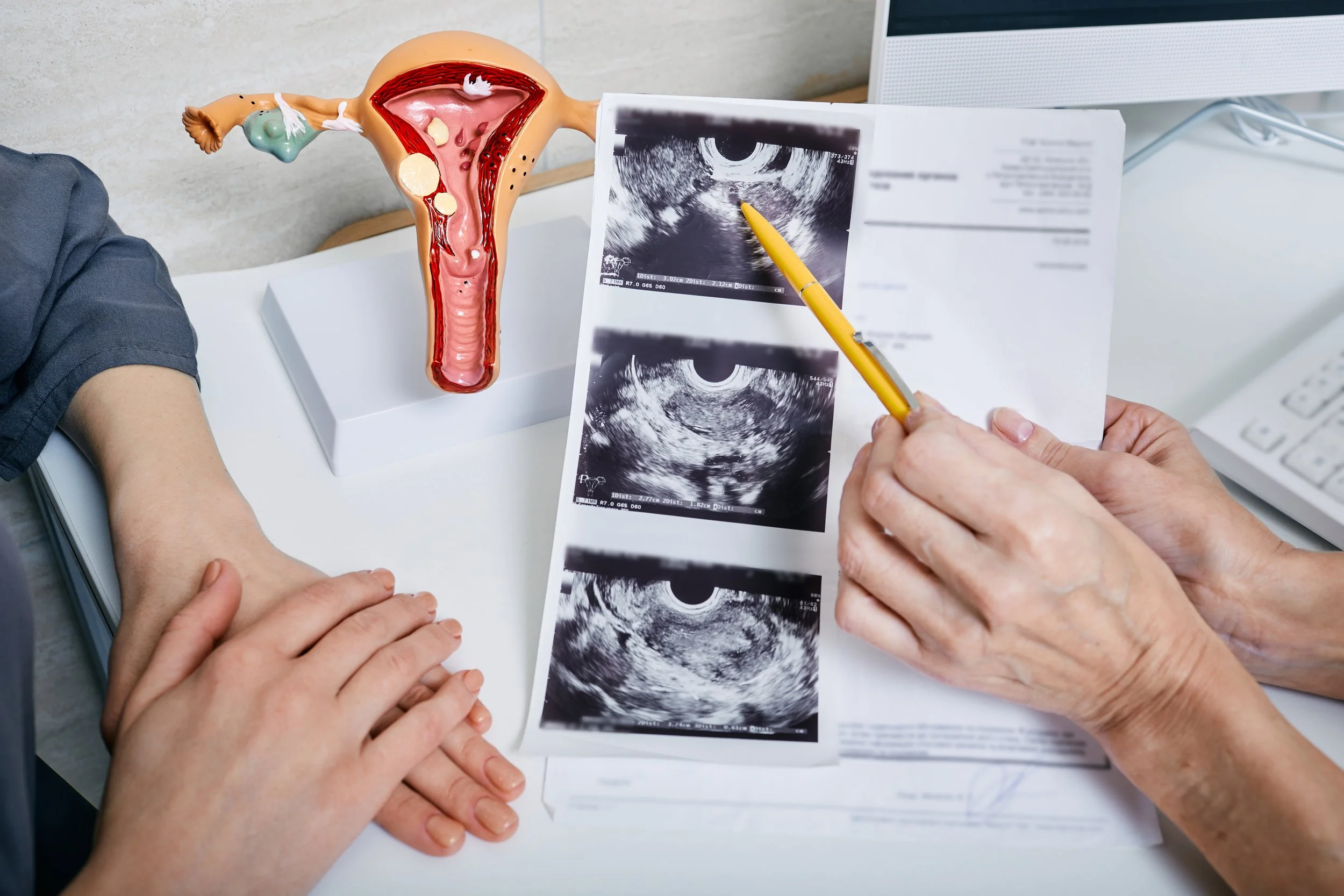Fertility Testing and Diagnosis