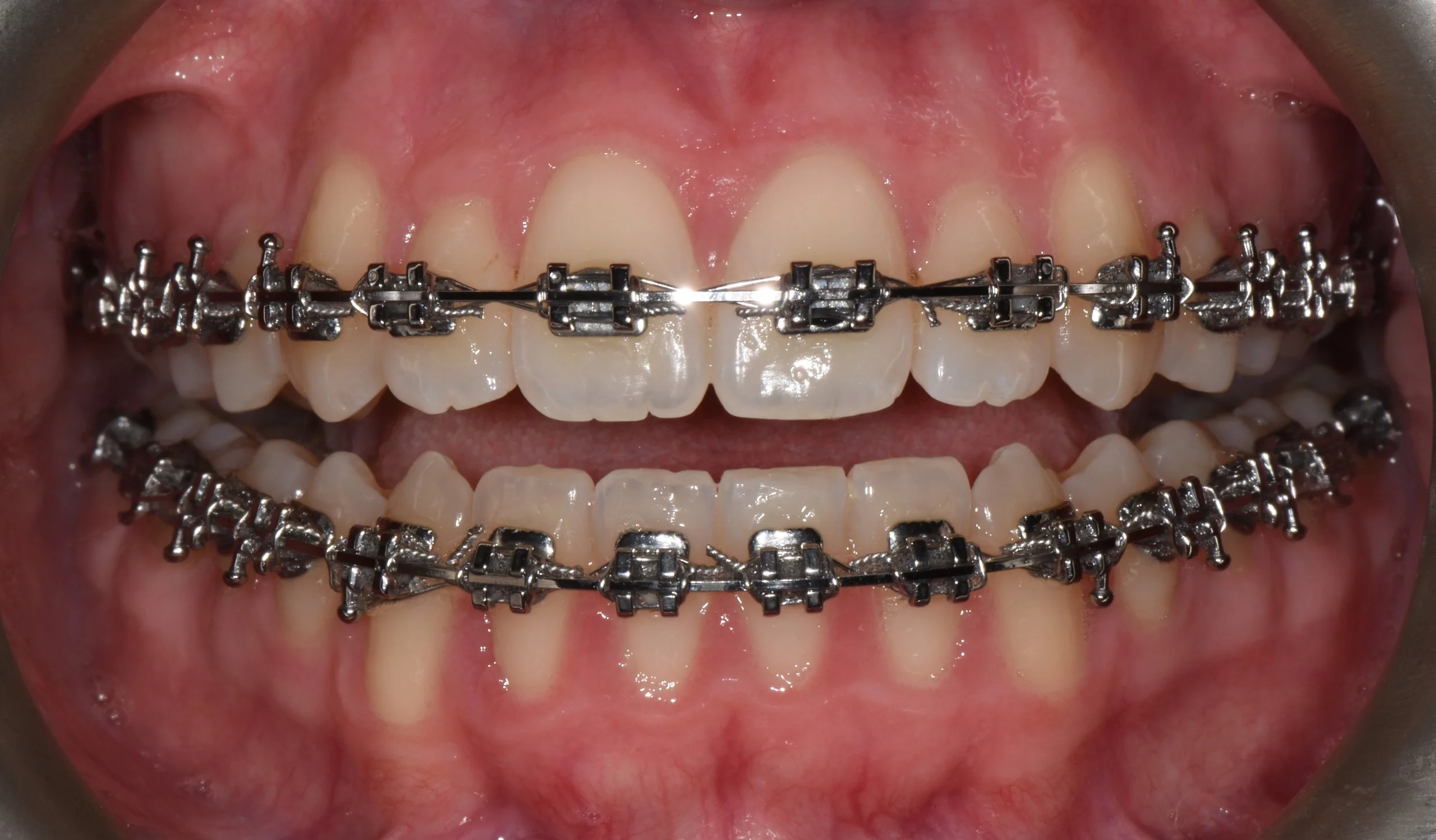 Foto di apparecchio fisso.JPG