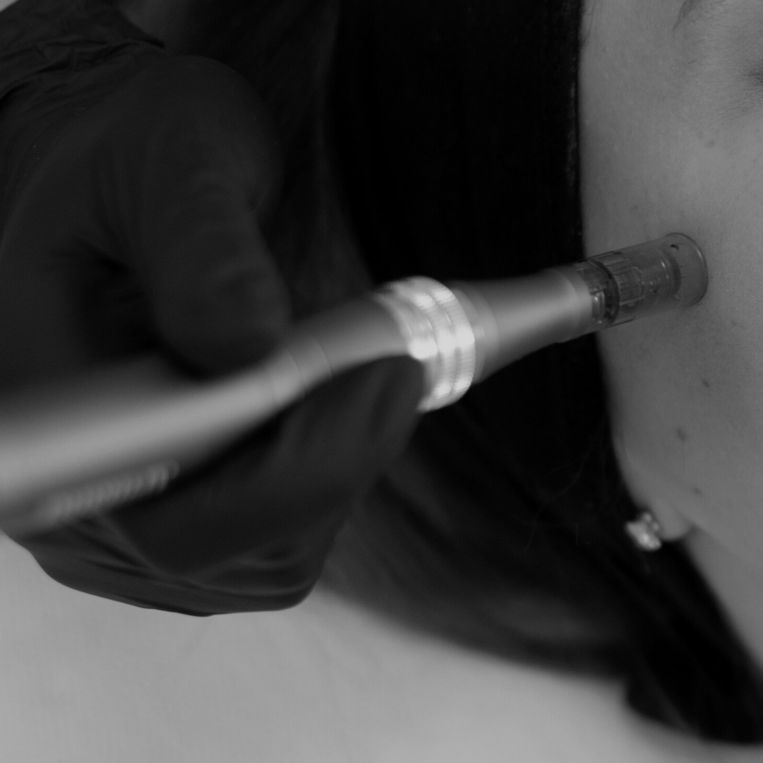 Medspa in Meridian, ID, 83646 | Microneedling Near Me.png