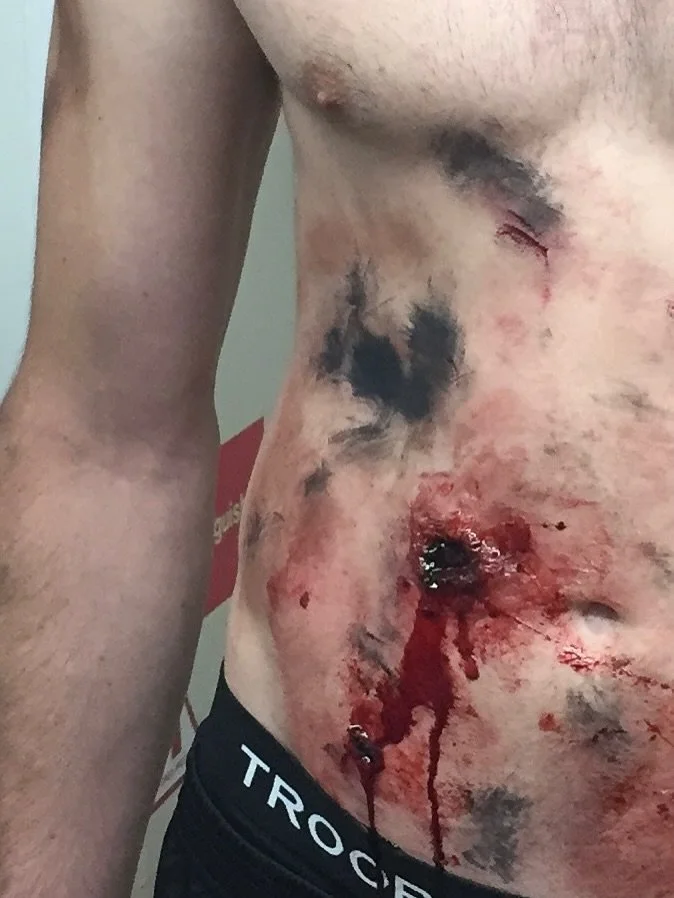 When you realise it&rsquo;s NOT Real - it&rsquo;s SFX Makeup - can you imagine the impact of seeing these simulated injuries in a medical training scenario. 

That&rsquo;s where Moulage plays its part, we create realistic simulated injuries for medic