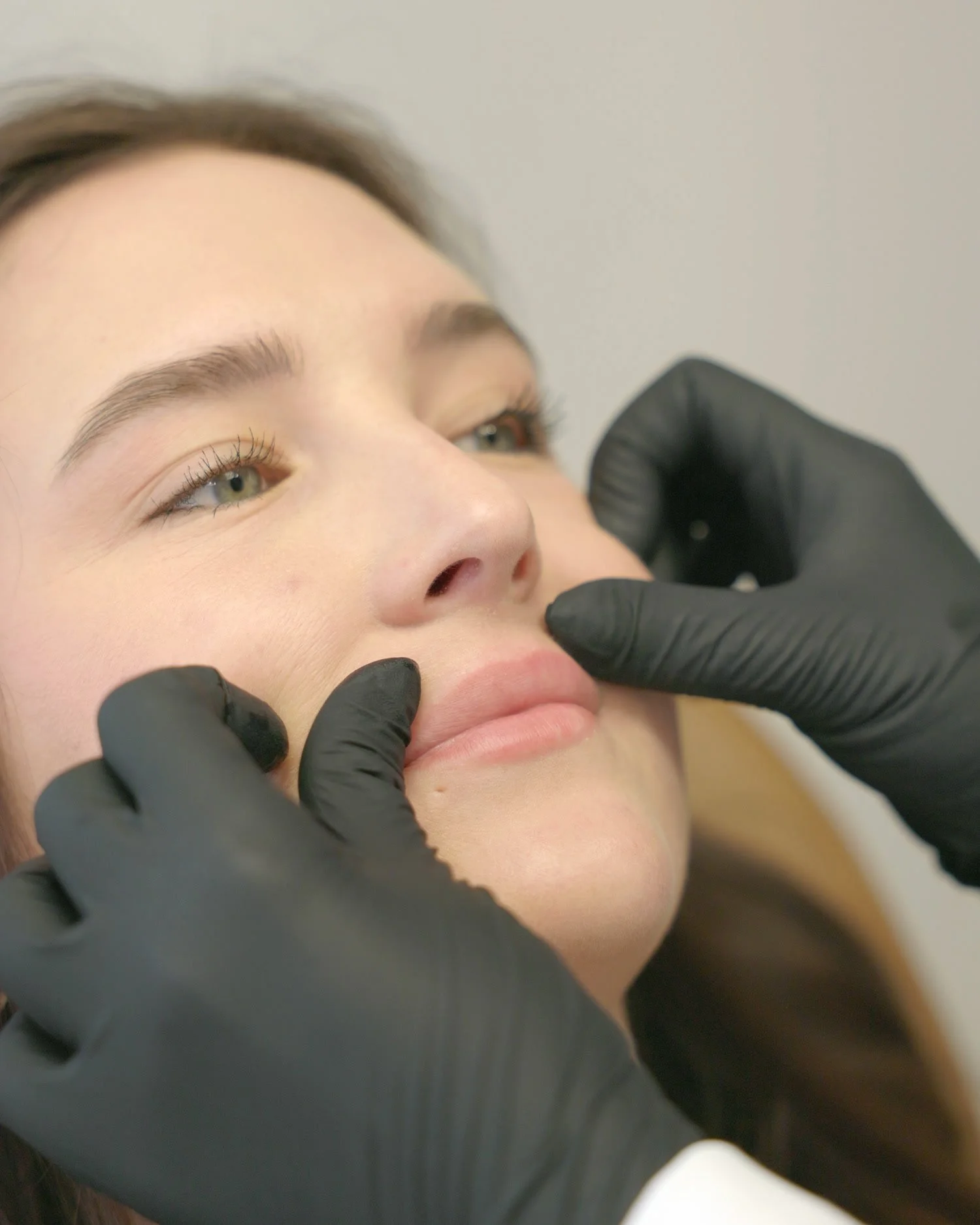 Gloved hands assessing a client's lips before lip filler at Luníc in Ottawa