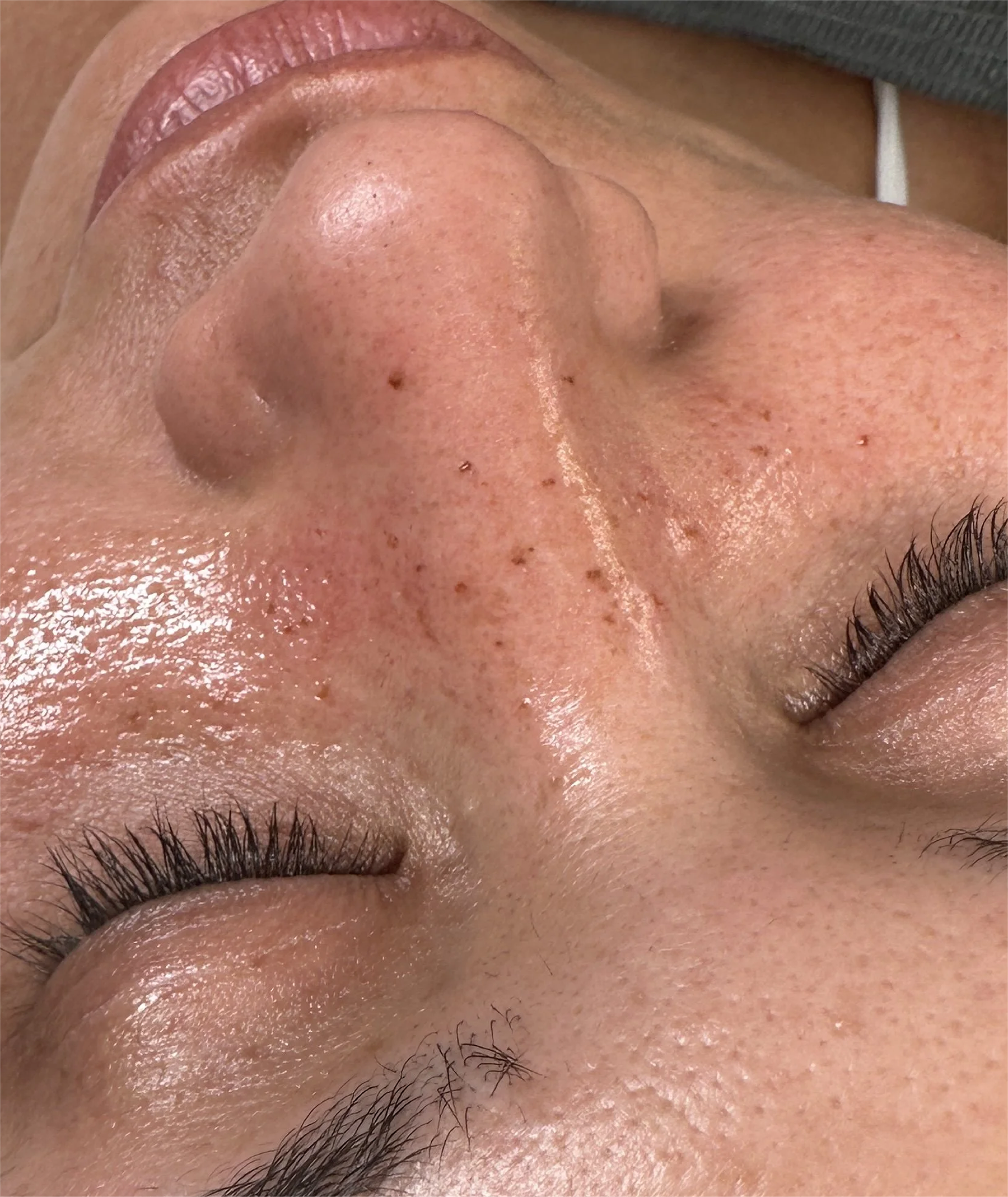 Supernatural Freckles