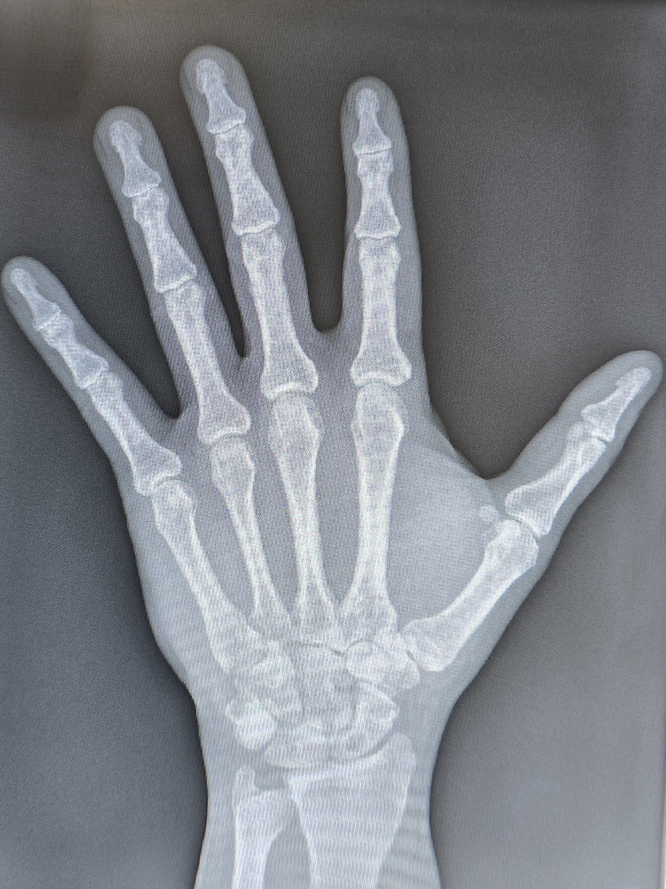 Christmas 2025: Hand-Made