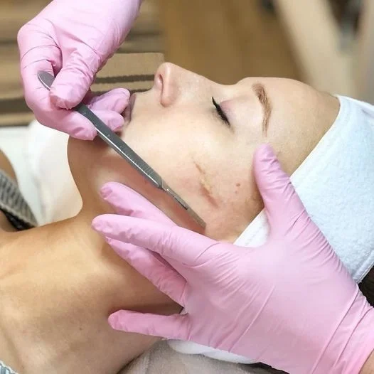 A woman receiving a facial treatment called dermaplaning with an aesthetic technician using a scalpel to remove peach fuzz and dead skin in Calgary