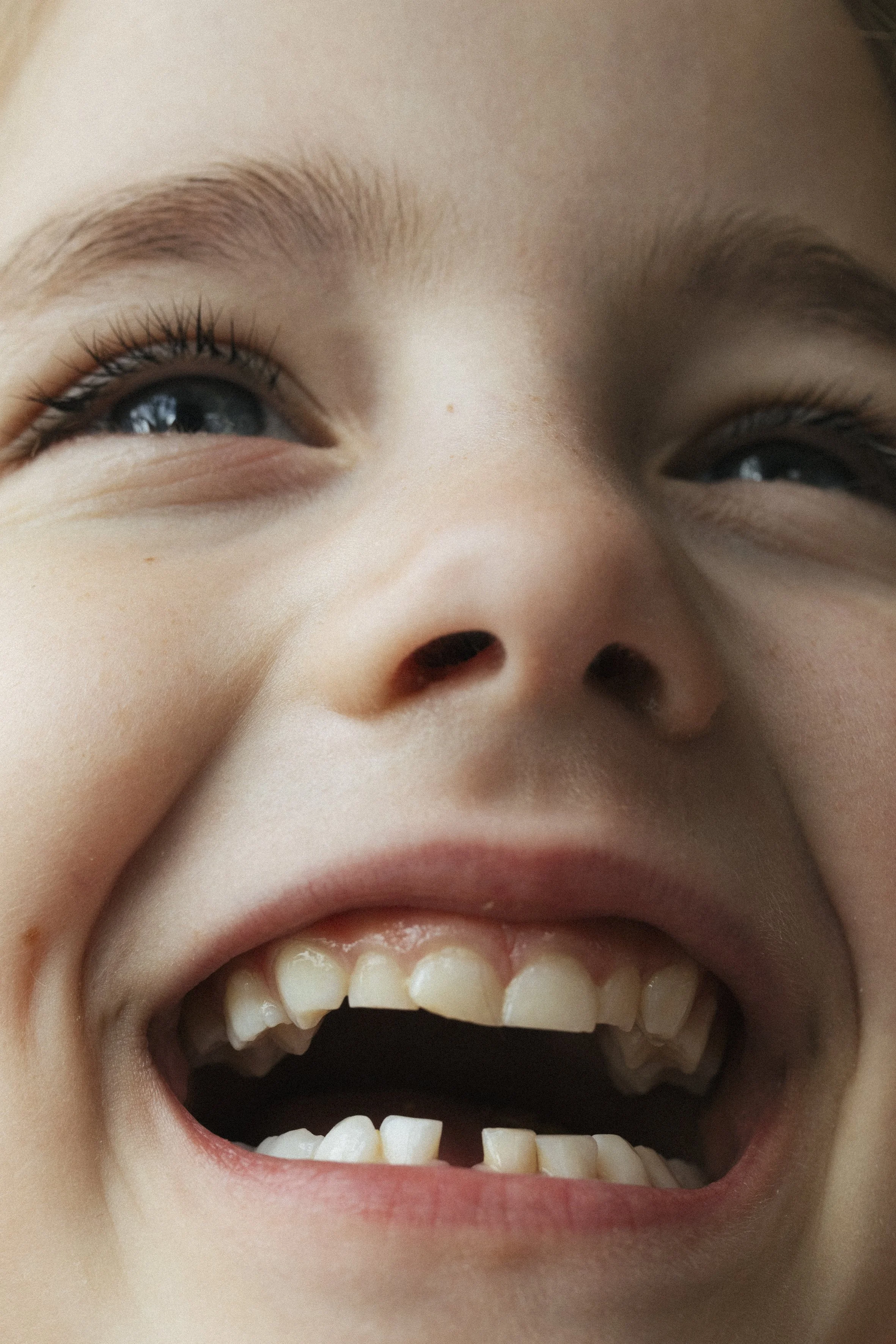 Missing tooth 
50X33CM
Ed 5 + 1AP