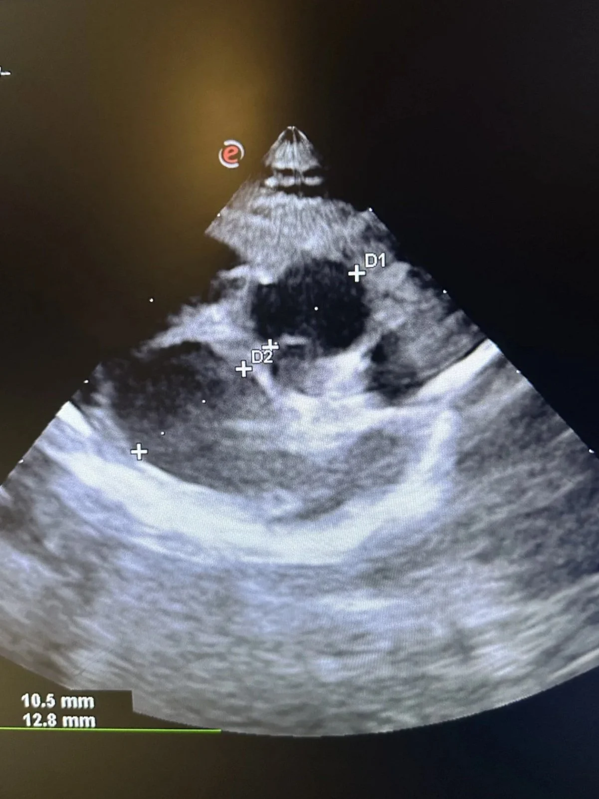 Ultrasound image