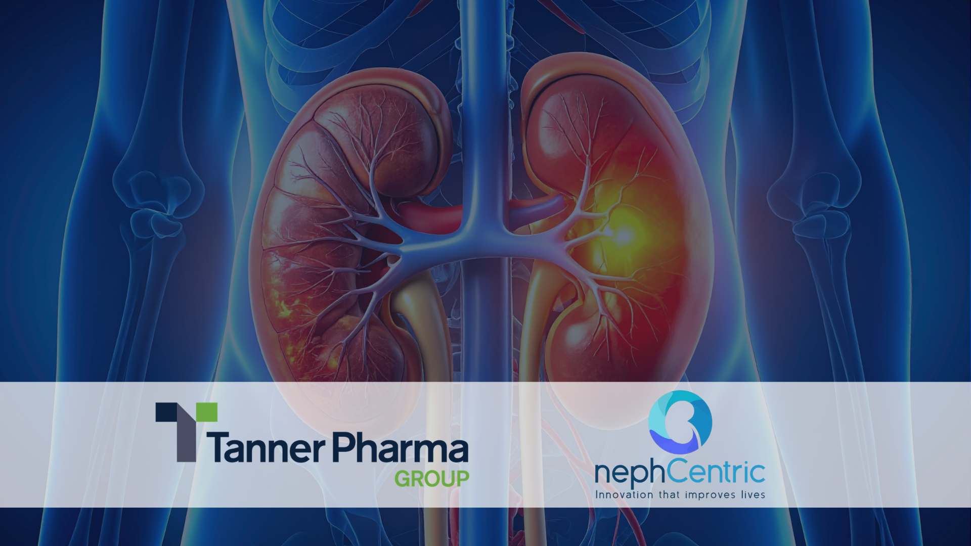 Tanner Pharma Group Signs Distribution Agreement with Nephcentric LLC