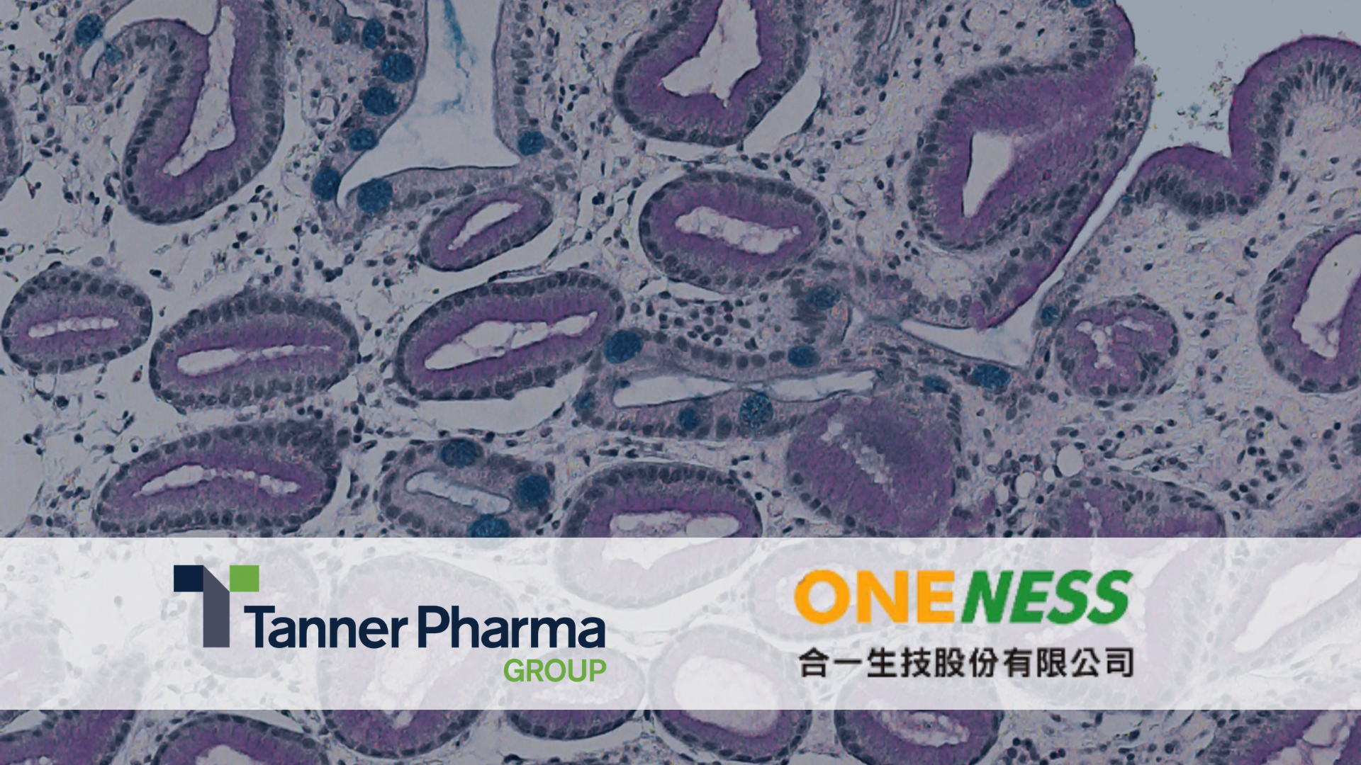 Oneness Biotech and Tanner Pharma Group Initiate Early Access Program for Fespixon®, a Novel Macrophage-regulating New Therapy for the Treatment of Diabetic Foot Ulcers