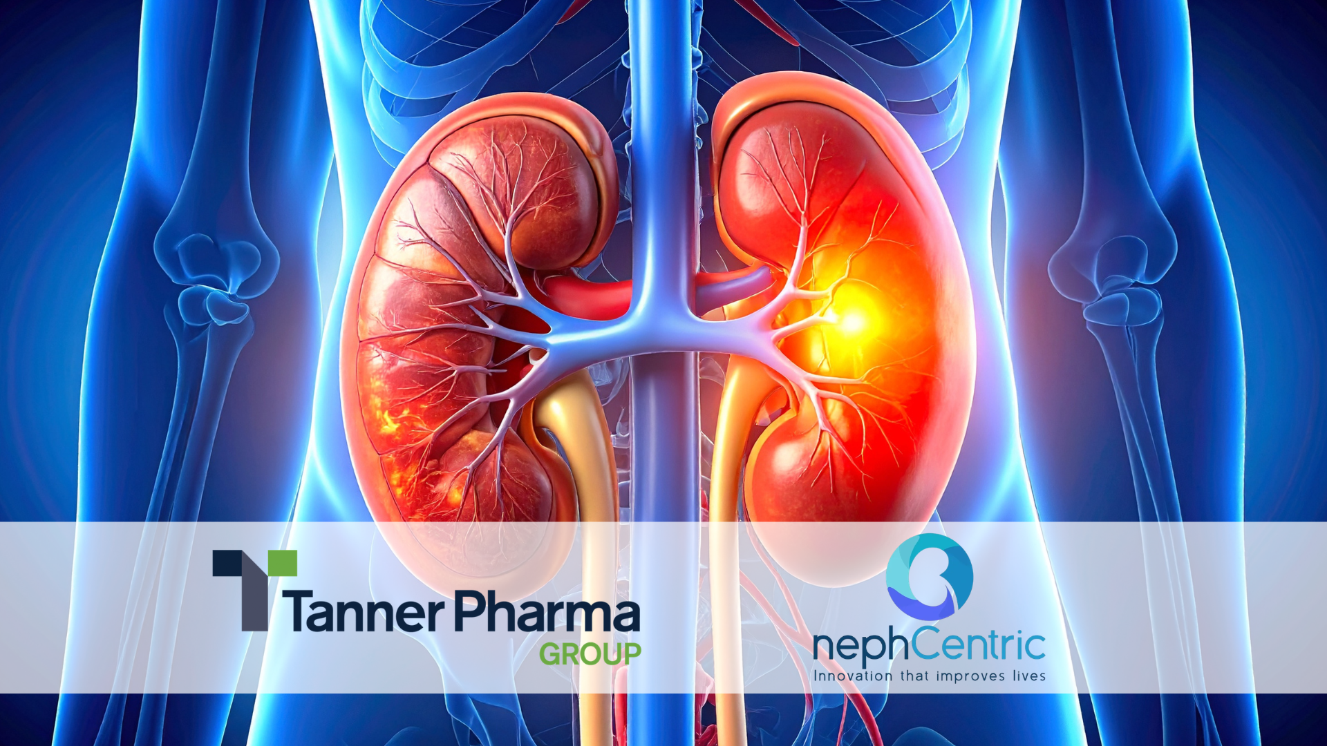 Tanner Pharma Group Signs Distribution Agreement with Nephcentric LLC