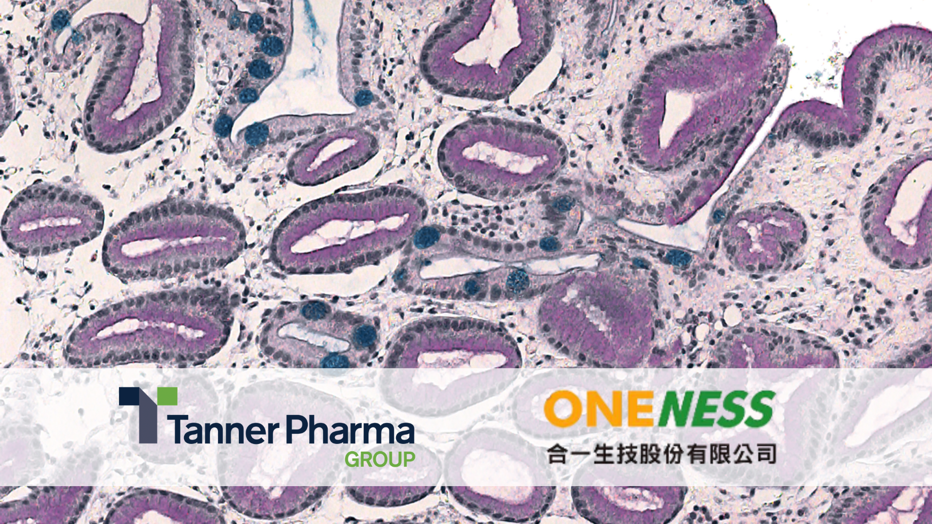 Oneness Biotech and Tanner Pharma Group Initiate Early Access Program for Fespixon®, a Novel Macrophage-regulating New Therapy for the Treatment of Diabetic Foot Ulcers