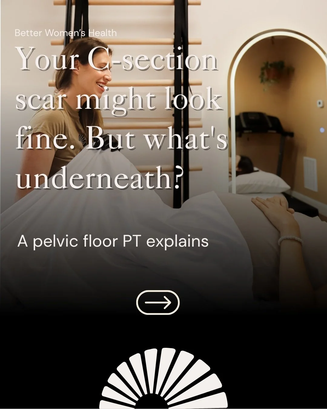 That C-section scar that "looks great"? It might still be holding onto a lot underneath.

Tightness around the scar. A pooch that won't go away. Low back or hip pain. Numbness. Painful sex. A core that just feels&hellip; off.

These aren't 