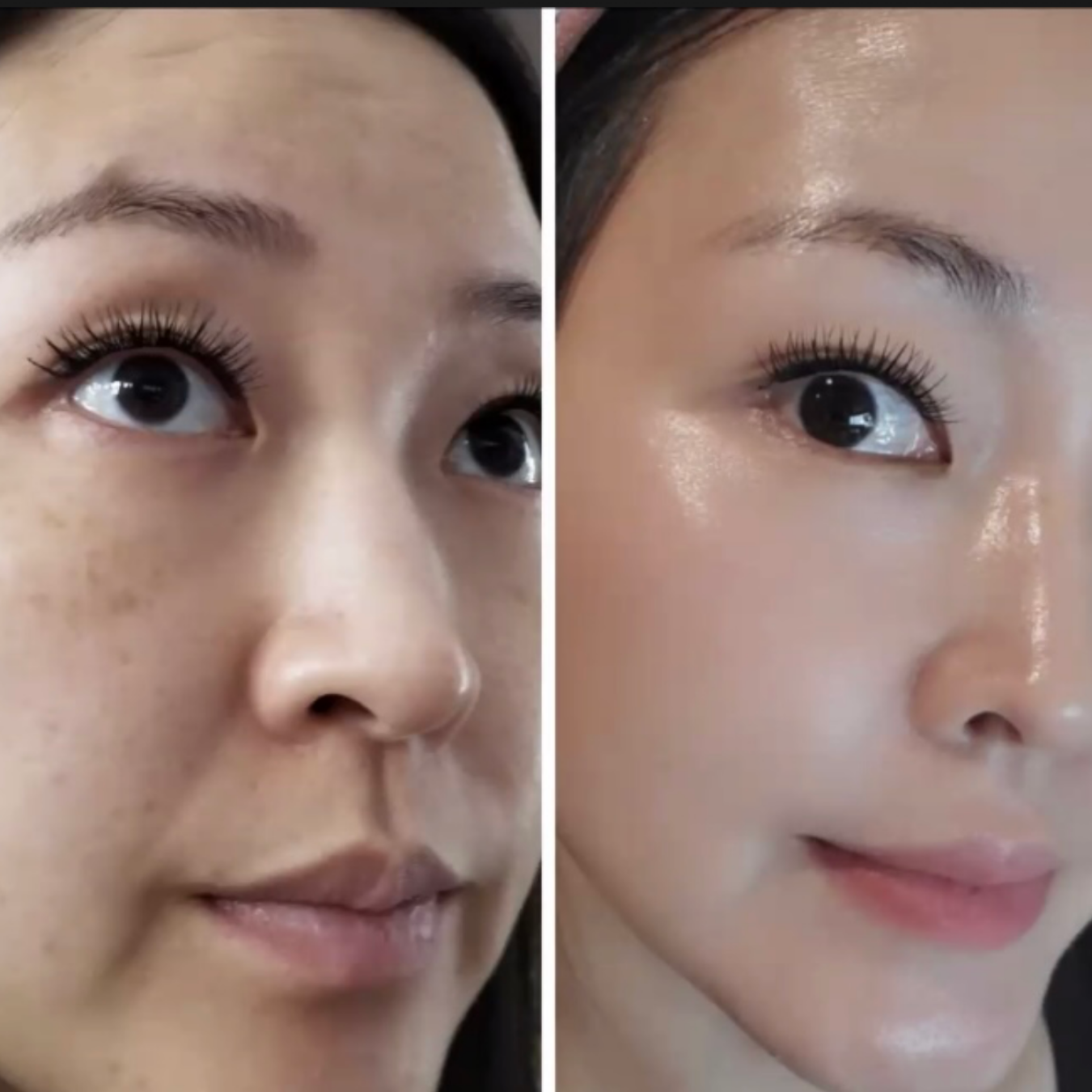Before and After.png