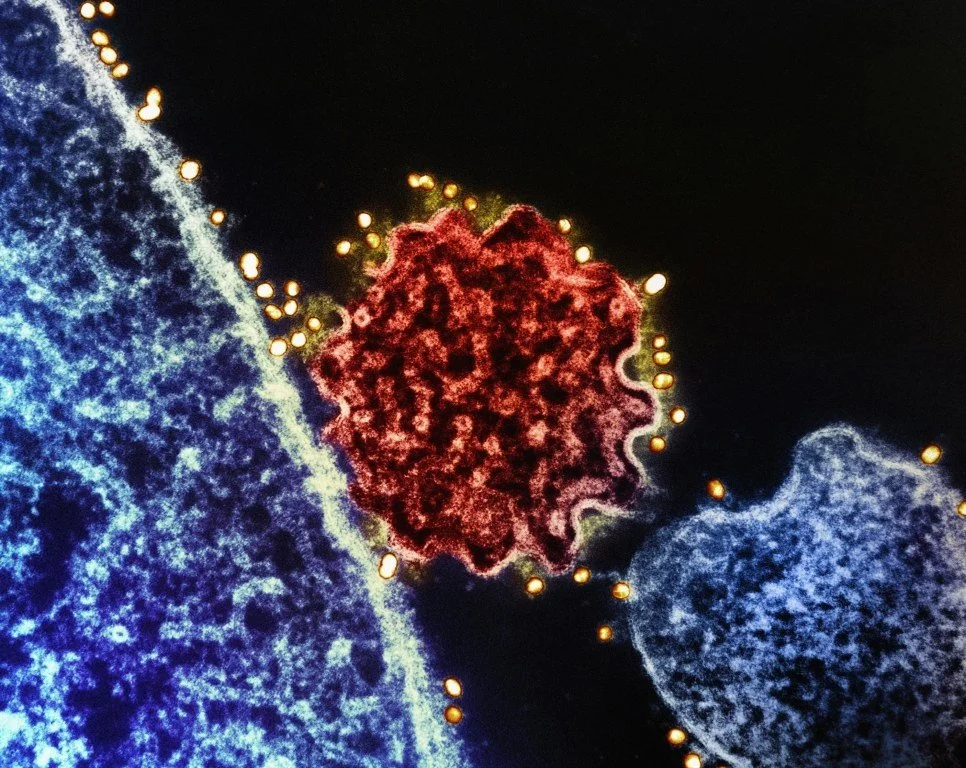 5 Root Causes of Autoimmune Disease and How to Start Healing