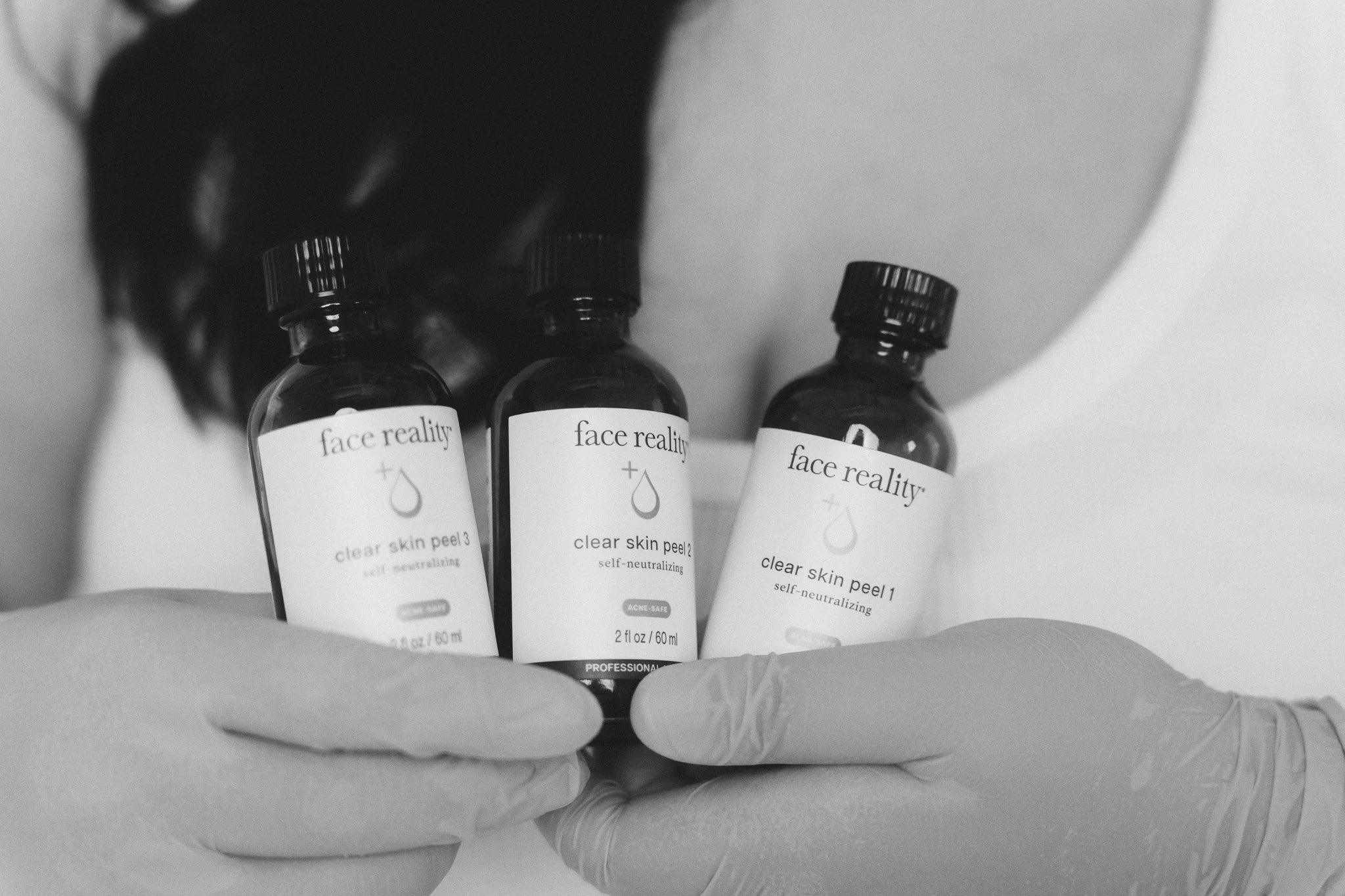 Face Reality Chemical Peel