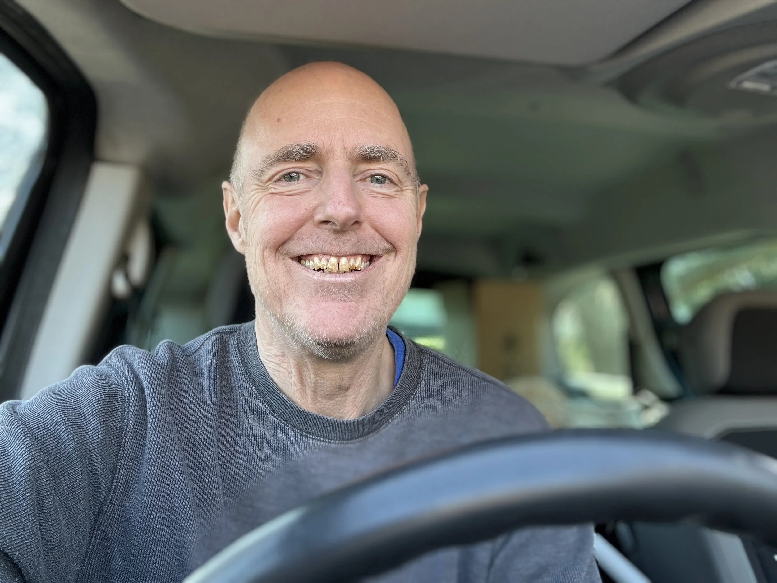 Smiling bald man with gold teeth in a vehicle, wearing a dark gray shirt, with a blurred vehicle interior and green scenery outside.
