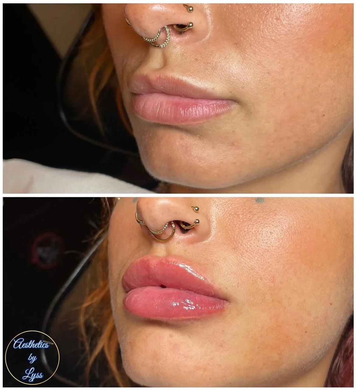 Comparison of a woman's lips before and after lip gloss application, showing natural lips in the top image and glossy, fuller lips in the bottom image, with face jewelry visible.