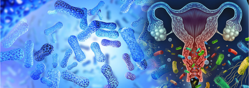 Multi-Strain Probiotic Therapy Shows Promise in Preventing Bacterial Vaginosis Recurrence