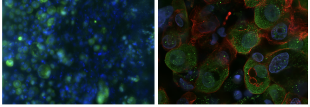 An Advanced Cervix-on-a-Chip Enables Mechanistic Studies of the Host-Microbiome-Pathogen Interactions