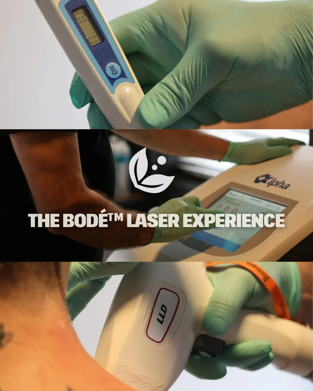 Every BOD&Eacute;&trade; consultation starts with a full skin assessment and MILO Melanin Reading to customize your treatment.

We tailor every plan to:
💎 Your hair type - coarse, fine, or dense
🌈 Your skin tone &amp; sensitivity
🎯 Your goals, fro