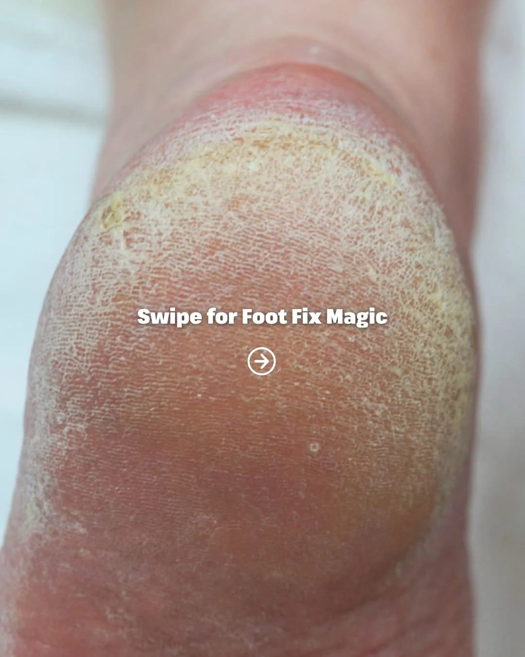 Combat dry winter feet the right way. Our CMP Foot Fix Pedicure restores moisture, smooths rough skin, and gets your feet back to looking and feeling their best.

Know someone whose feet could use a little winter TLC? A BOD&Eacute;&trade; gift card i