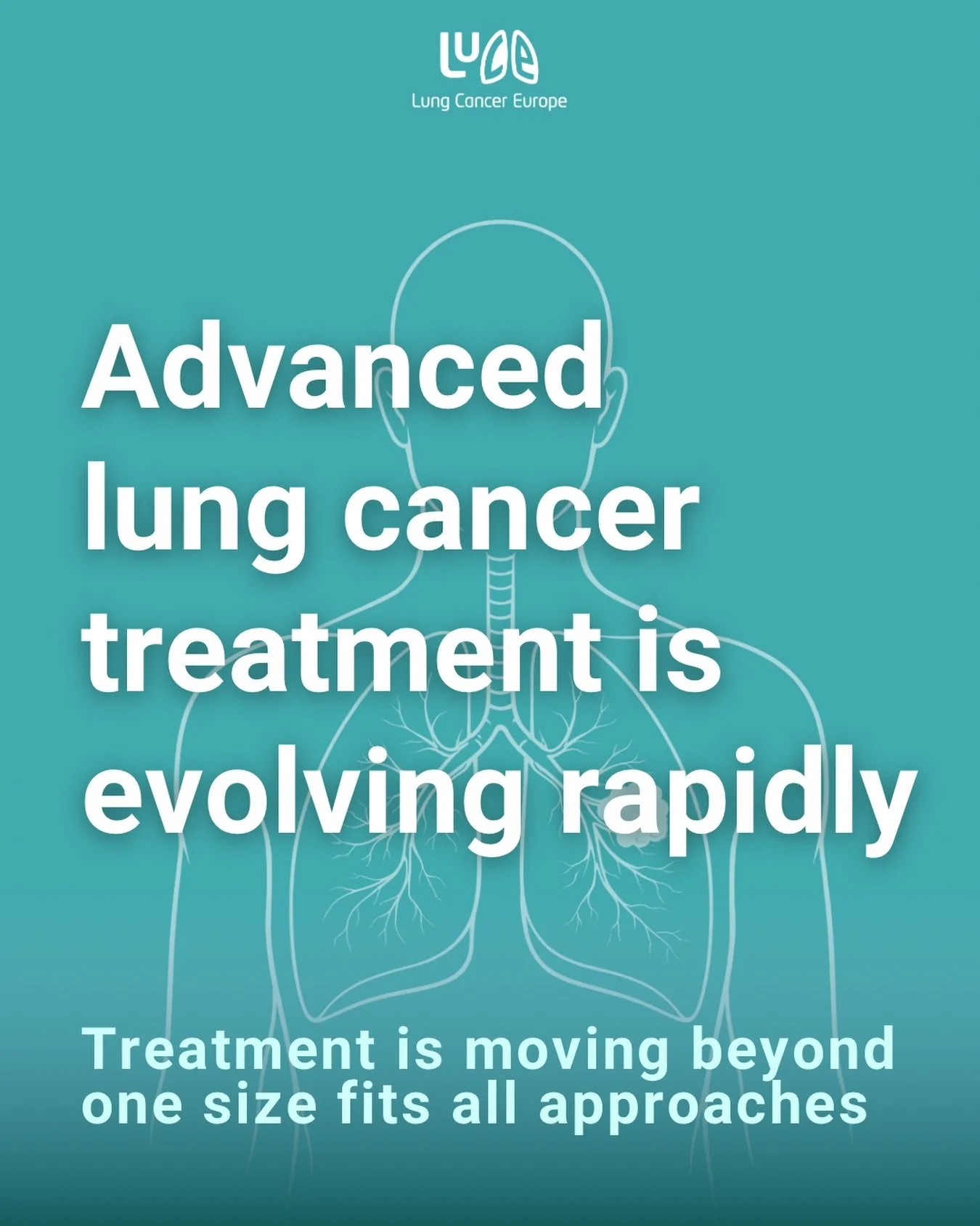 Advanced lung cancer treatment is changing quickly, and this is being driven by solid evidence.

A recent review in Thoracic Surgery Clinics brings together how frontline treatment for advanced non small cell lung cancer is now shaped by broad biomar