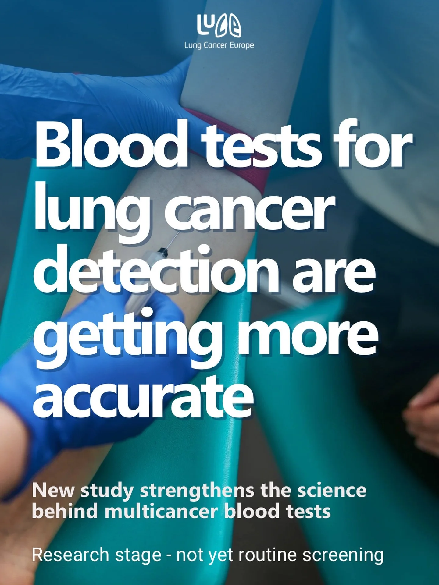Survival in lung cancer is closely linked to stage at diagnosis.

A new open-access study in Nature Cancer shows that combining DNA methylation with fragment analysis improves the accuracy of multicancer blood tests compared with methylation alone.

