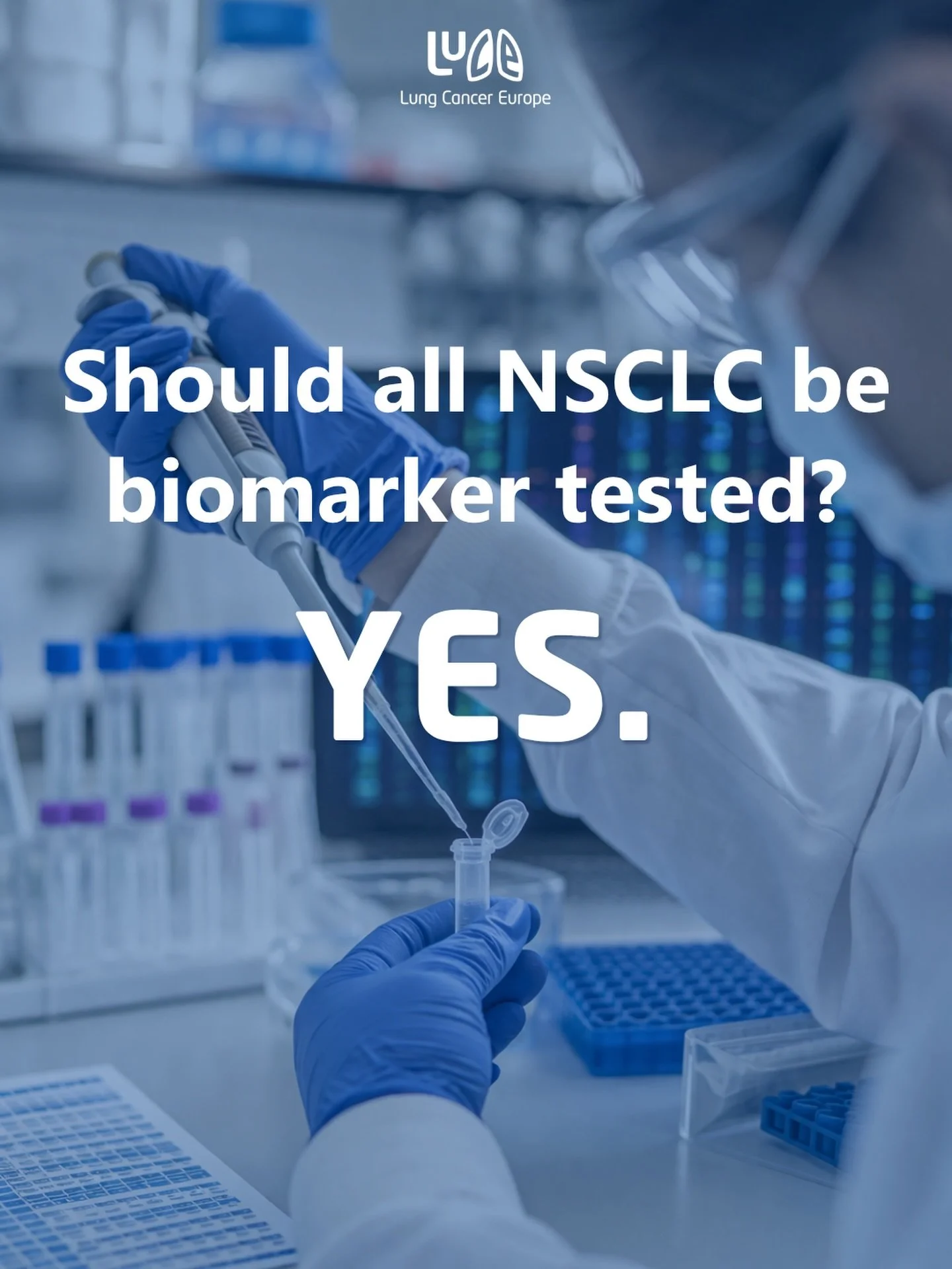 Should all NSCLC be biomarker tested? Yes.

A major new study adds to the case for broad biomarker testing in non-small cell lung cancer.

Looking at molecular profiling data from more than 82,000 people with lung cancer, the study found enough bioma