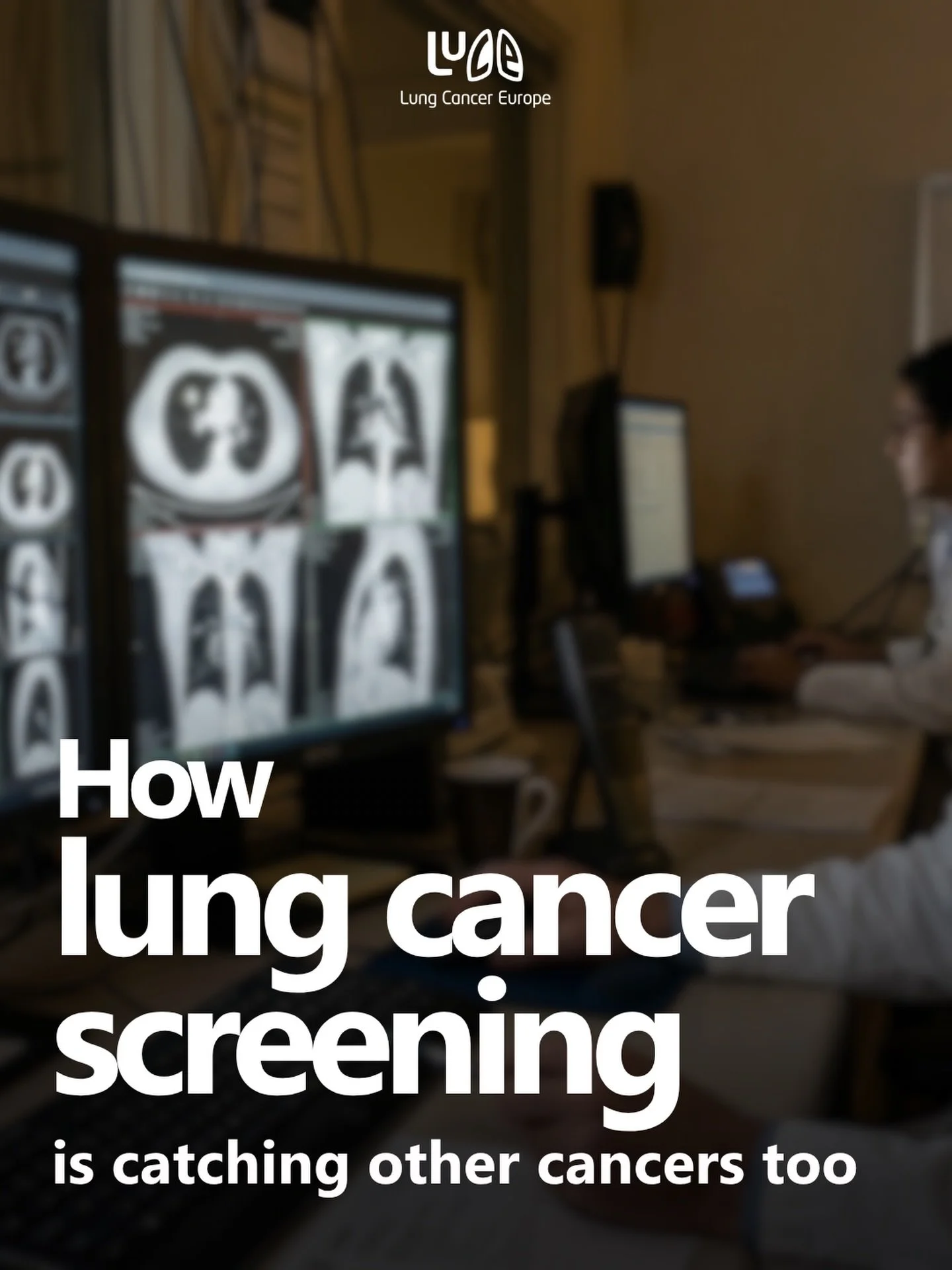 Lung cancer screening programmes may have unexpected benefits beyond lung cancer.

A new study shows that screening scans are picking up signs of other cancers too. Researchers tracked over 26,000 people through multiple rounds of screening. 

Those 