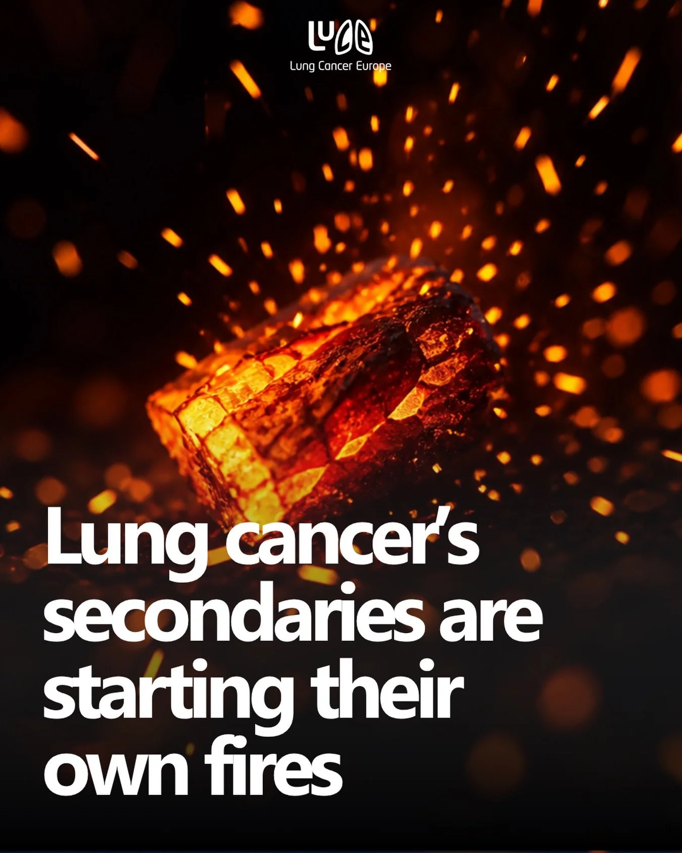 What if the tumour we&rsquo;ve been focused on isn&rsquo;t the one doing the most damage?

A landmark study just published in Nature has changed how scientists understand the way lung cancer spreads through the body and the findings matter deeply for
