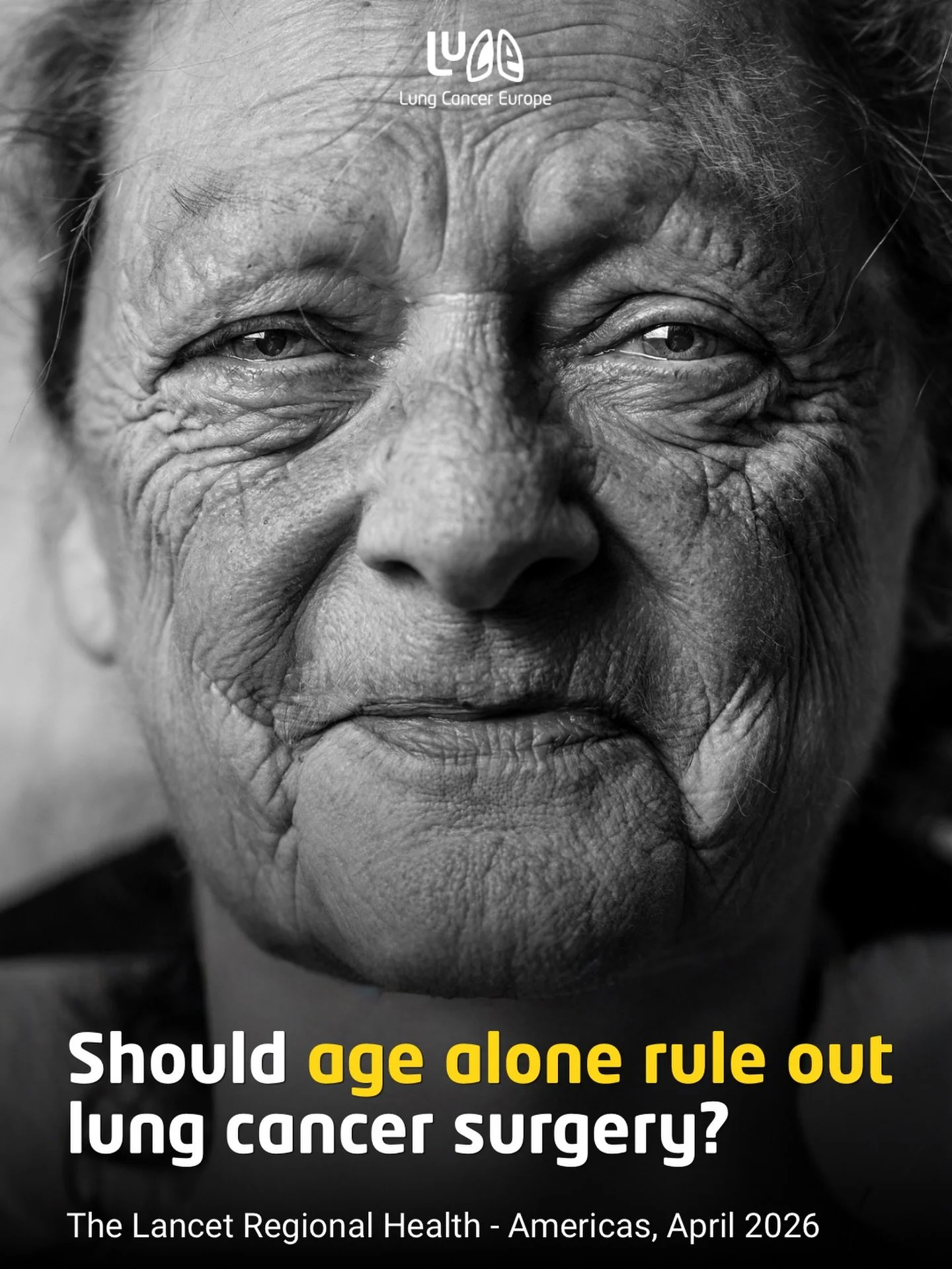 Should age alone rule out lung cancer surgery?

A prospective cohort study in The Lancet Regional Health &ndash; Americas looked at people aged 80 and older with Stage IA non-small cell lung cancer who had surgery.

Older adults had higher complicati