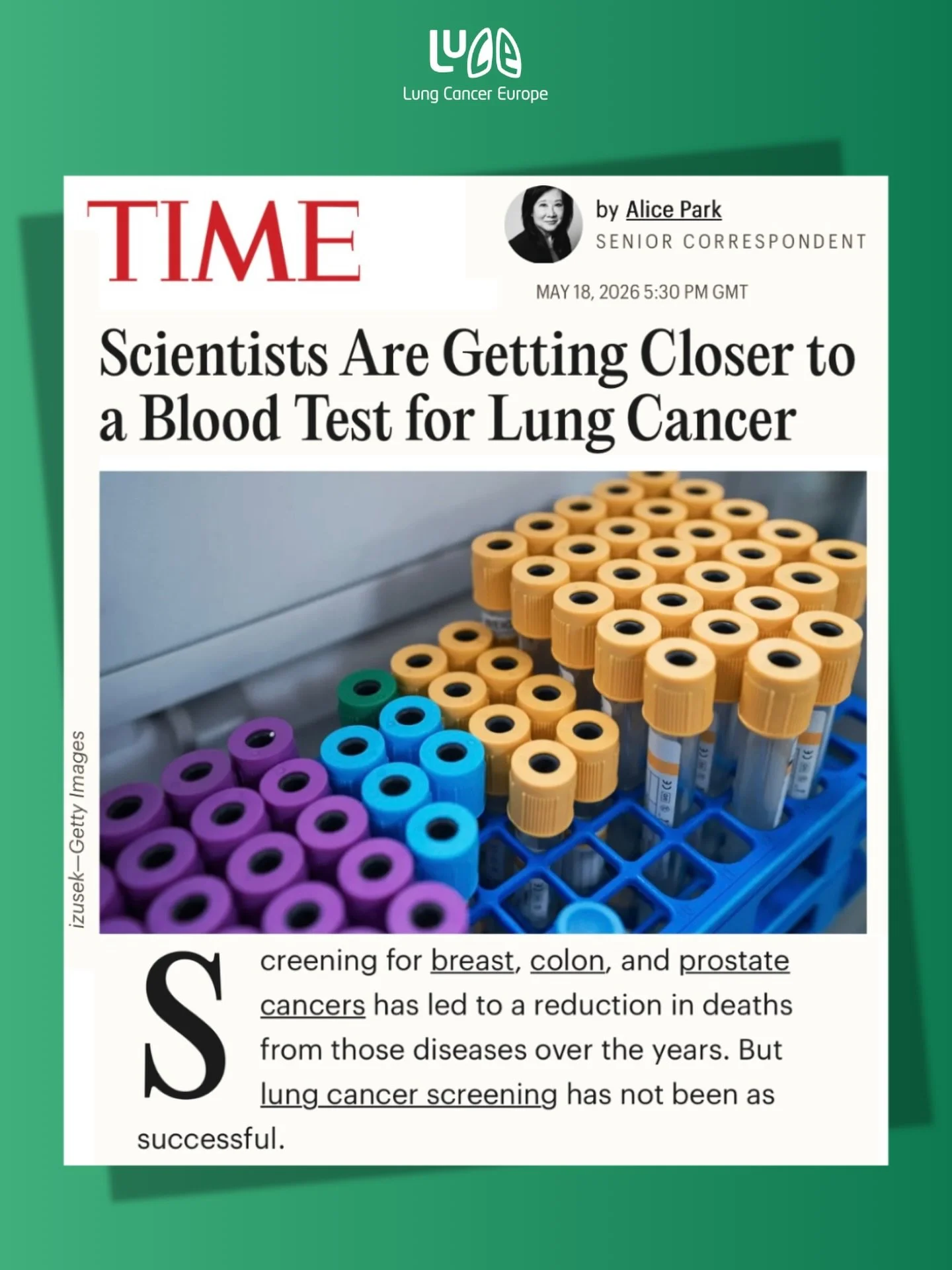 Screening for lung cancer has long been harder than for other cancers. Unlike breast or colon cancer, there is no simple, widely available test. Eligibility for screening has largely depended on smoking history, which means many people at risk are ne