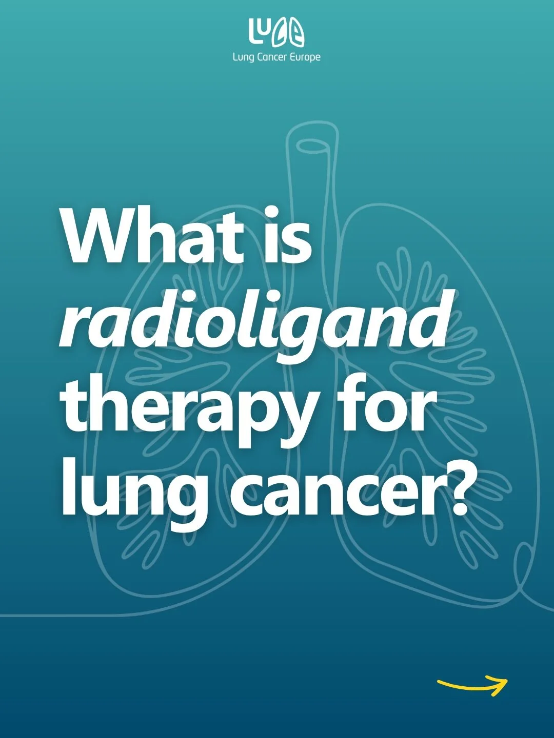 Radioligand therapy is a way to treat cancer using a tiny amount of radioactivity, delivered directly to cancer cells.

Already used in prostate and neuroendocrine cancers, studies are now underway in small cell lung cancer, where greater understandi