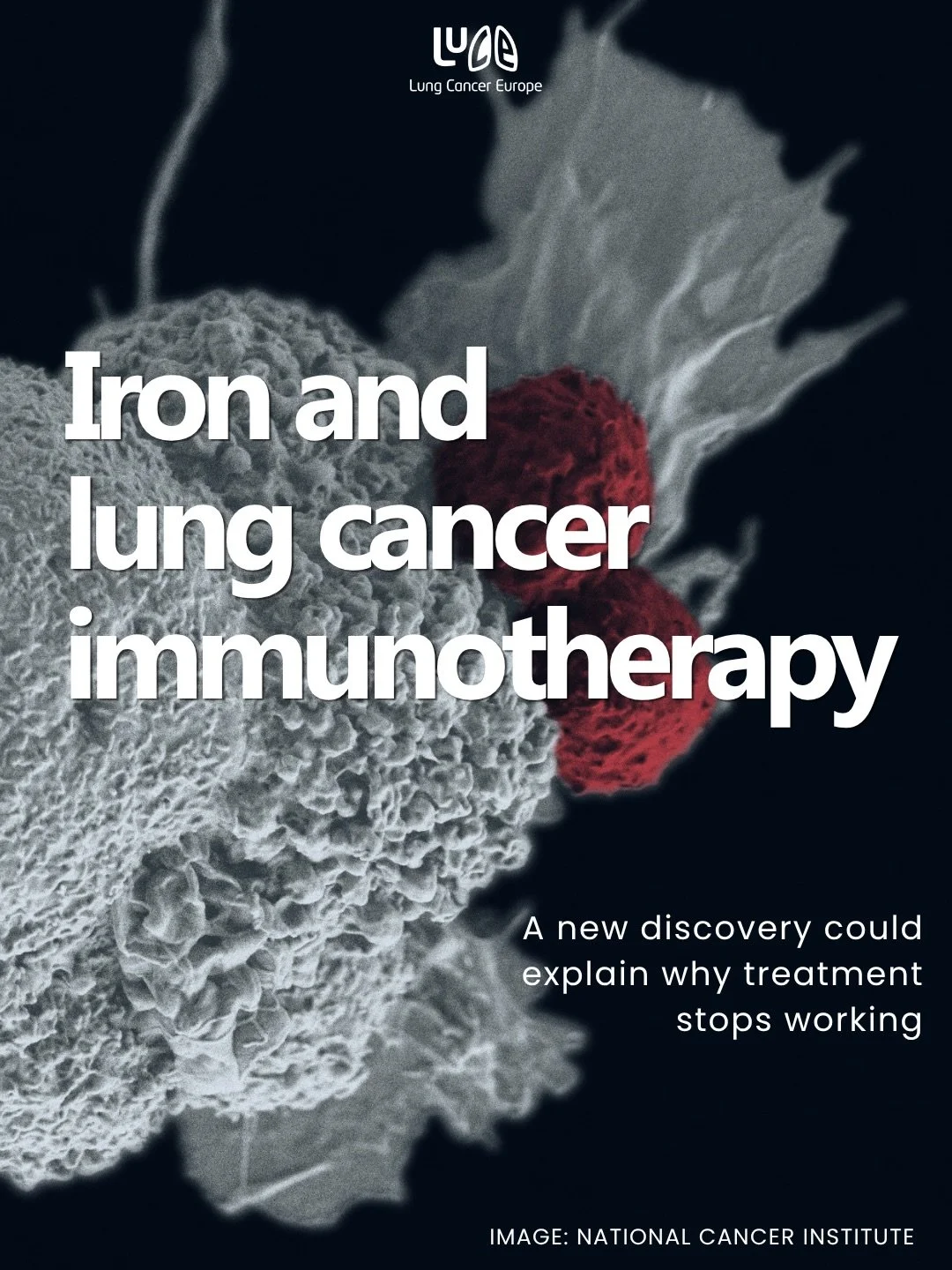 Why does immunotherapy sometimes stop working? It is one of the most important questions in cancer research right now, and it is getting the scientific attention it deserves.

A study published this week in Nature Cancer adds a surprising new piece t
