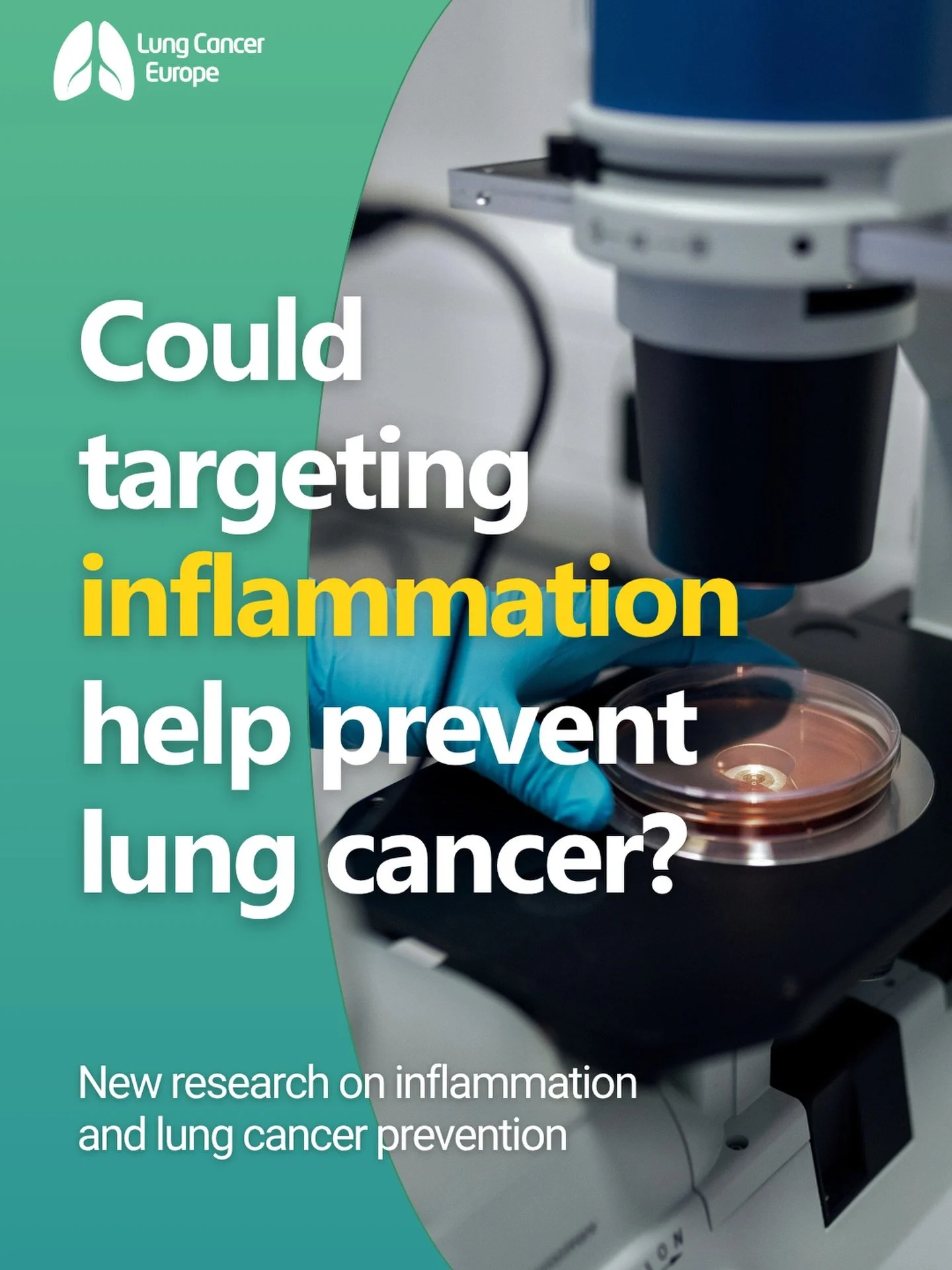 Could inflammation become a target for lung cancer prevention?

New research in Science Advances looked at caspase-1, an enzyme involved in inflammation.

Researchers found that blocking this pathway reduced lung tumour development in preclinical mod