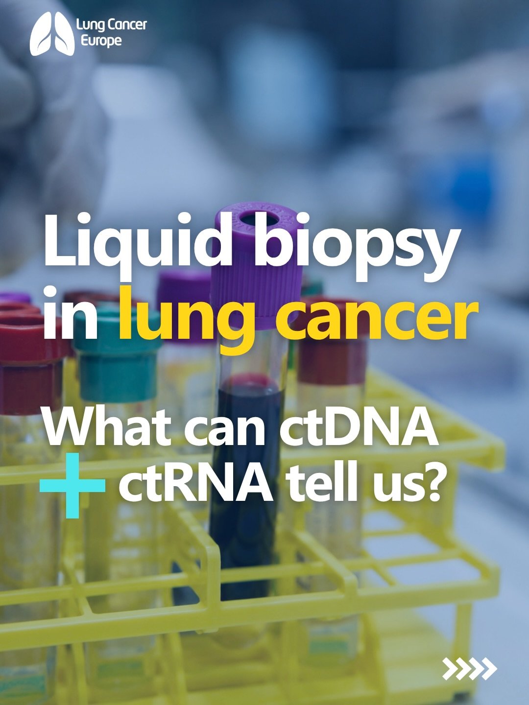 Blood tests are becoming an increasingly useful way to learn more about lung tumours.

In NSCLC, ctDNA can help identify genetic changes that may guide treatment. Newer research suggests ctRNA can add more information, especially for some gene fusion