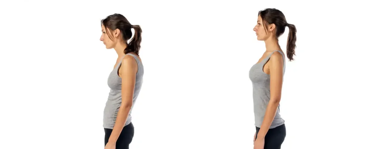 The image displays a side-by-side comparison of a person demonstrating poor posture, characterized by forward head and rounded shoulder positioning, and improved, upright posture.