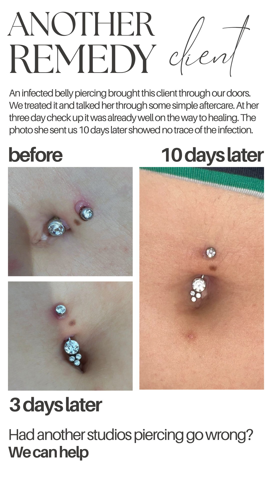 A comparison of two navel piercings over three days, showing healing progress with the top image labeled 'before' and the right side showing 10 days later and the bottom side showing 3 days later.